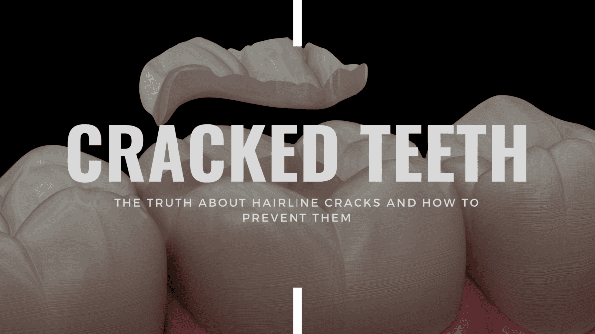 Cracked Teeth What Are Hairline Cracks & How To Prevent Them