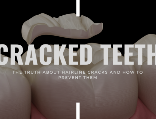 Cracked Teeth: The Truth About Hairline Cracks and How to Prevent Them