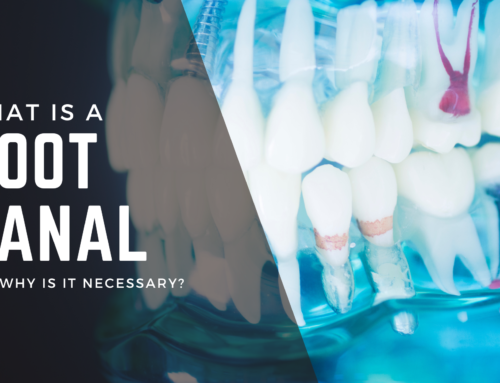What Is A Root Canal And Why Is It Necessary?