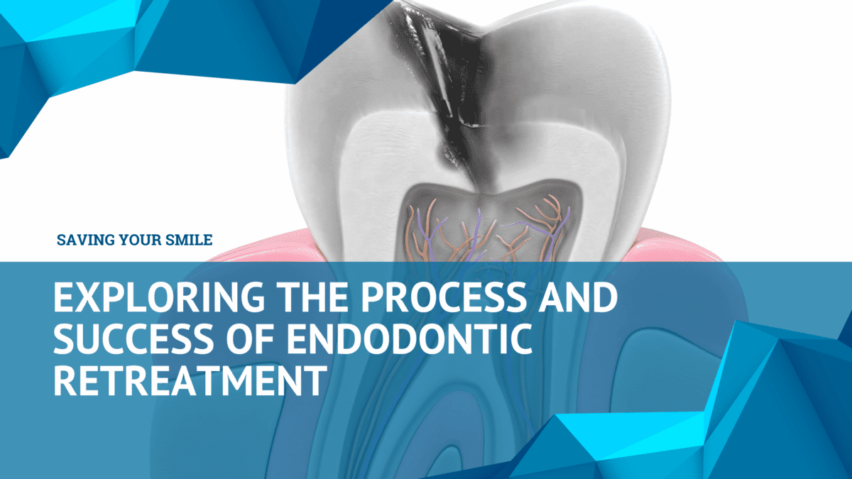 Saving Your Smile Process & Success of Endodontic Retreatment