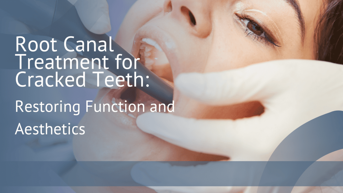 Restoring Cracked Teeth Understanding Root Canal Treatment Eastern