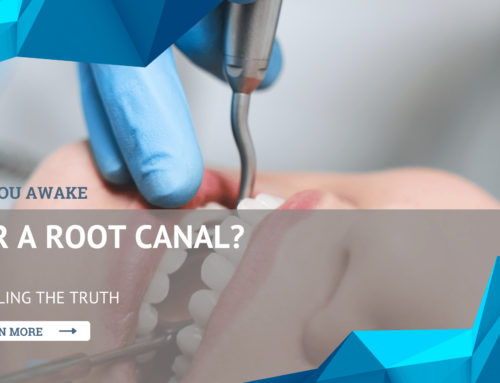 Are You Awake for a Root Canal? Unveiling the Truth