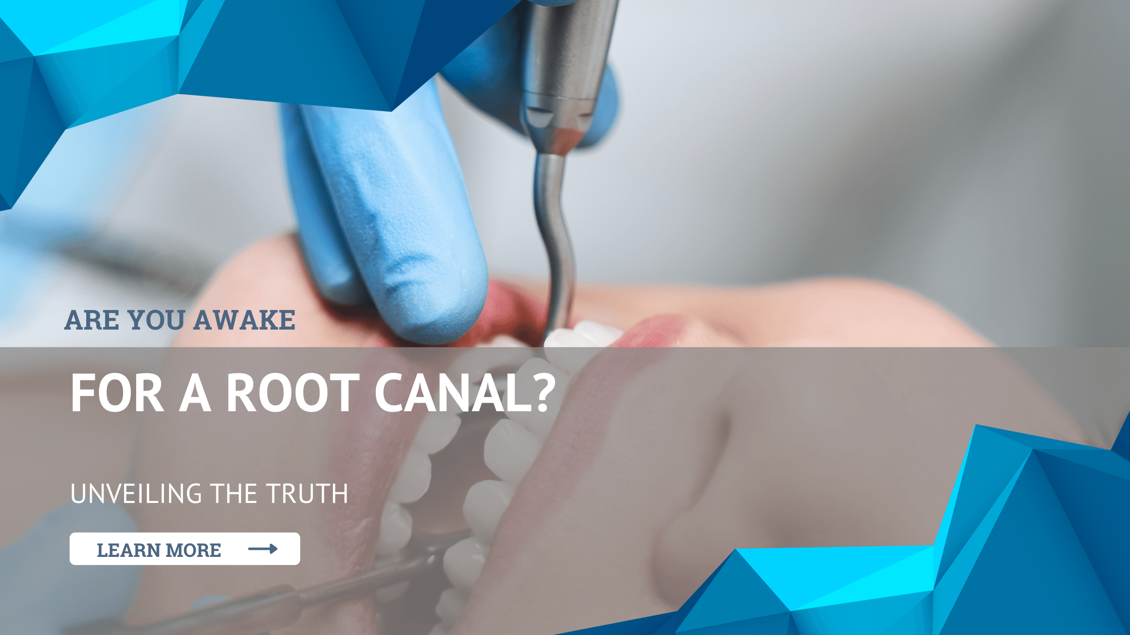 Are You Awake for a Root Canal?