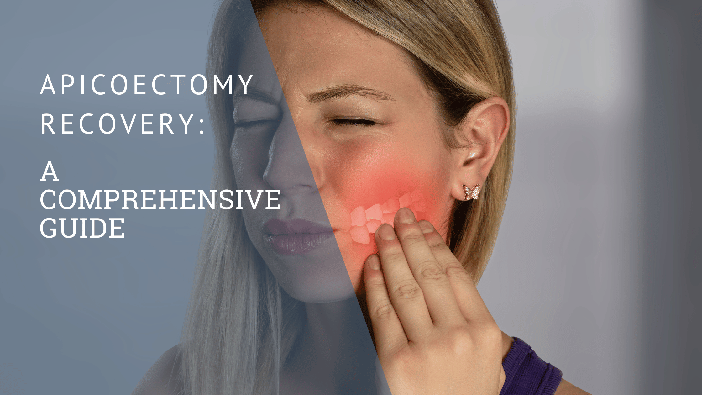 Apicoectomy Recovery