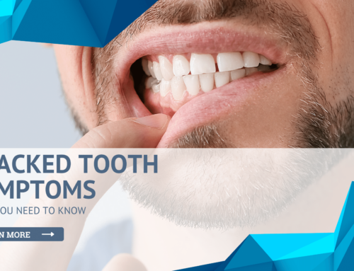 Cracked Tooth Symptoms: What You Need to Know