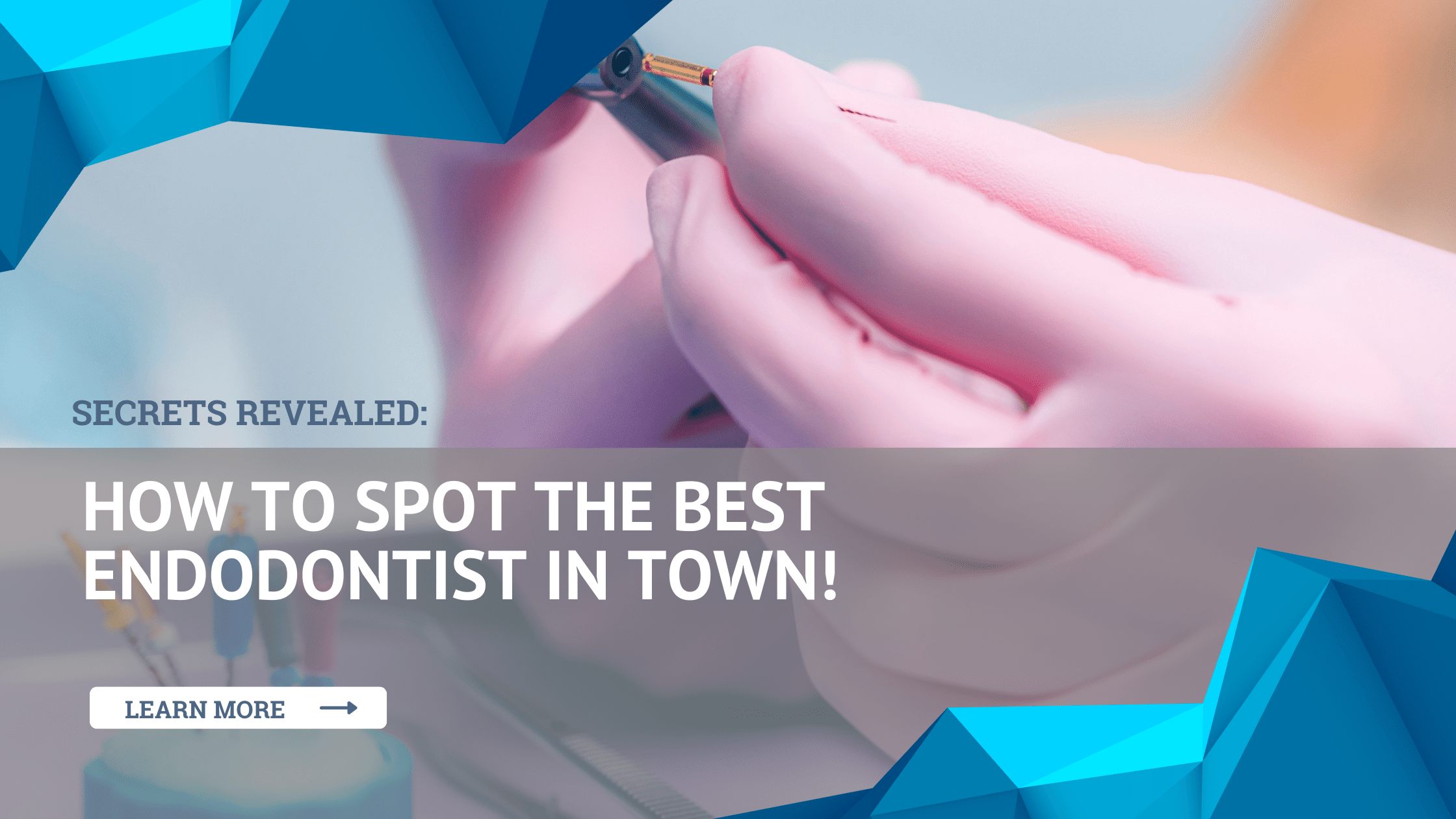 How to Spot the Best Endodontist in Town!
