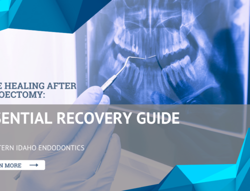 Bone Healing After Apicoectomy: Essential Recovery Guide by Eastern Idaho Endodontics