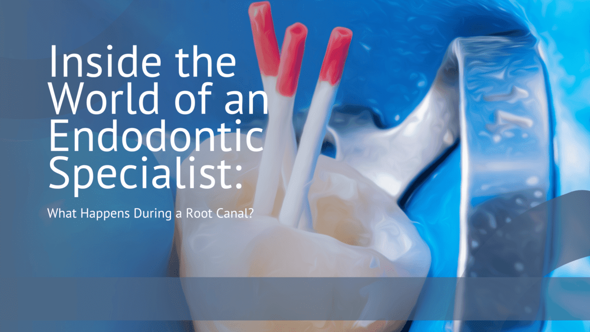 Root Canal Explained A Journey with an Endodontic Specialist