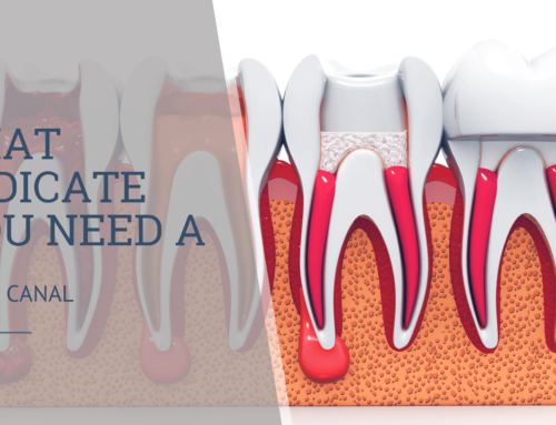 5 Signs That Indicate You Need a Root Canal