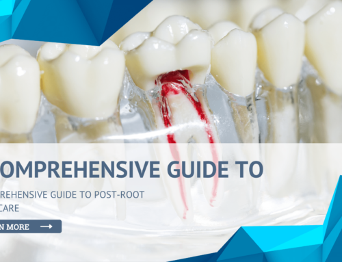 A Comprehensive Guide to Post-Root Canal Care