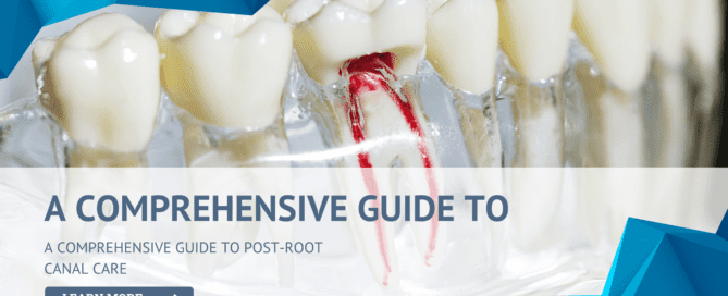 A Comprehensive Guide to Post-Root Canal Care