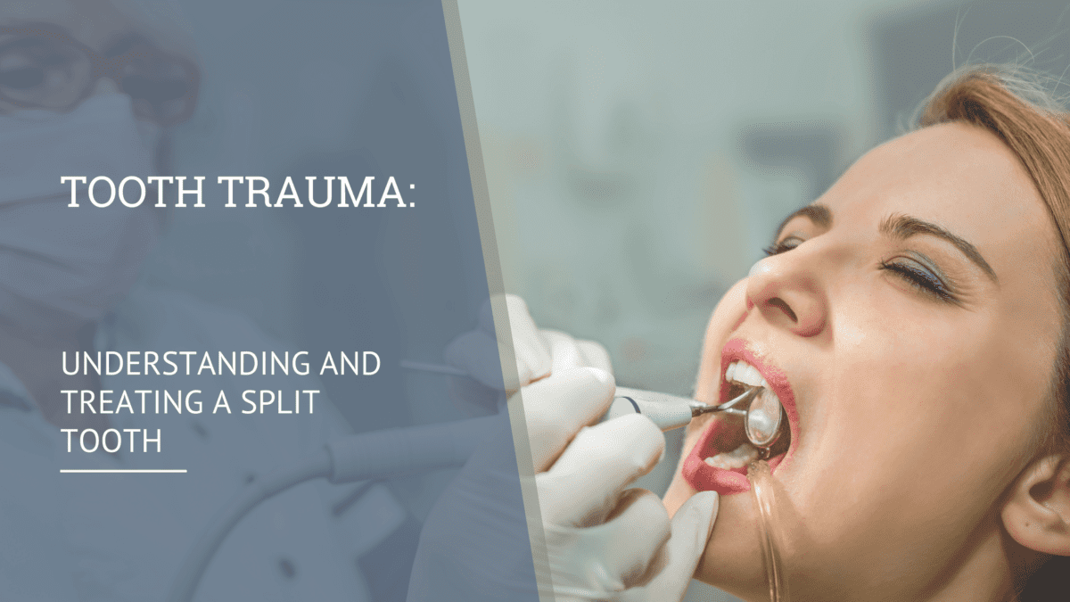 Tooth Trauma: Understanding and Treating a Split Tooth - Eastern Idaho ...