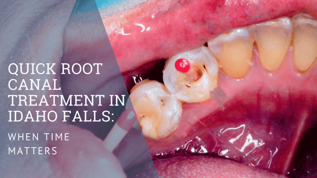 Quick Roots Quick Root Canal Treatment in Idaho Falls: When Time Matters - Eastern ...