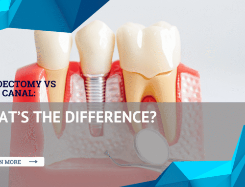 Apicoectomy vs Root Canal: What’s the Difference?
