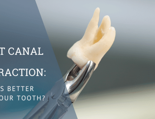 Root Canal vs. Extraction: What’s Better for Your Tooth?