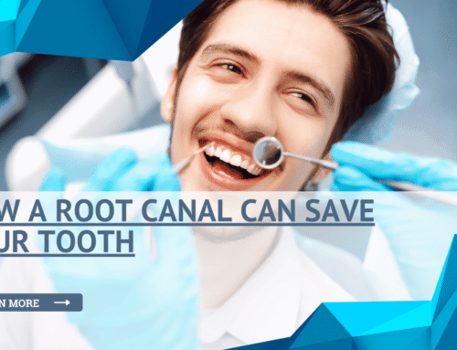 How a Root Canal Can Save Your Tooth—and Your Smile