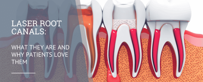 Laser Root Canals