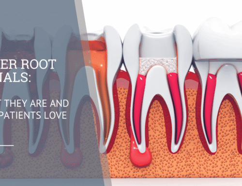Laser Root Canals: What They Are and Why Patients Love Them