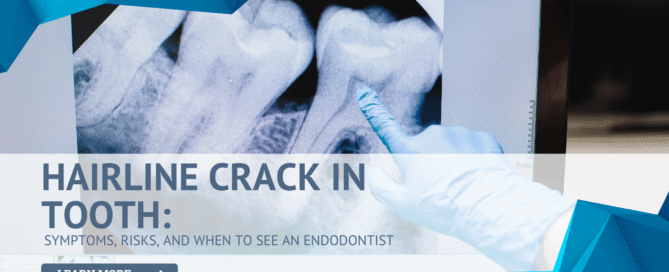 Hairline Crack in Tooth