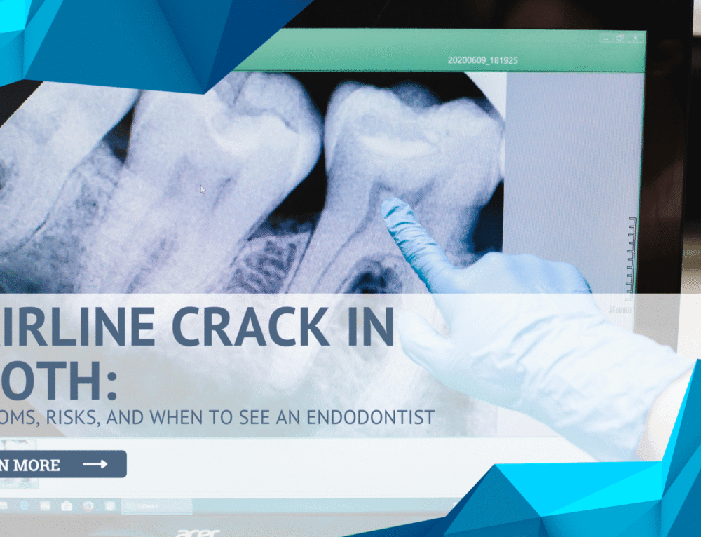 Tooth Trauma: Understanding and Treating a Split Tooth - Eastern Idaho ...