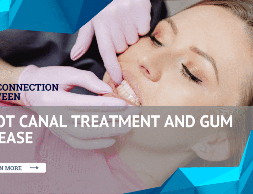 The Connection Between Root Canal Treatment and Gum Disease