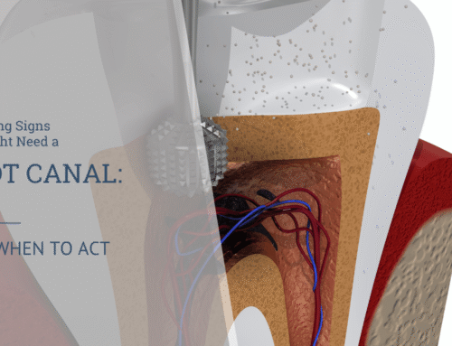 7 Warning Signs You Might Need a Root Canal (and When to Act Fast)