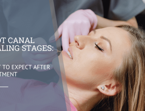 Root Canal Healing Stages: What to Expect After Treatment
