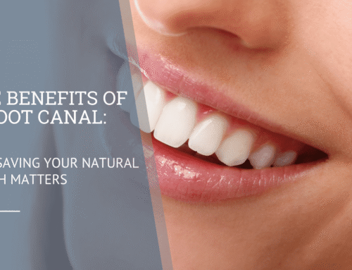 The Benefits of a Root Canal: Why Saving Your Natural Tooth Matters