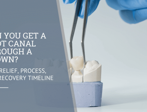 Can You Get a Root Canal Through a Crown? Pain Relief, Process, and Recovery Timeline