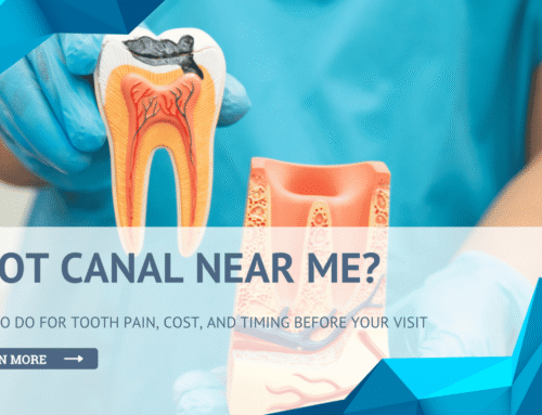Root Canal Near Me? What to Do for Tooth Pain, Cost, and Timing Before Your Visit