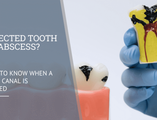 Infected Tooth or Abscess? How to Know When a Root Canal Is Needed