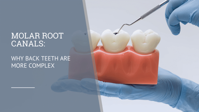 Molar Root Canal: Why Back Teeth Are More Complex