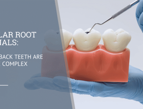 Molar Root Canals: Why Back Teeth Are More Complex