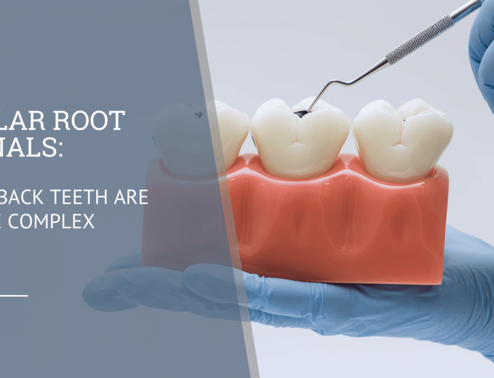 Root Canal Healing Stages: What to Expect After Treatment - Eastern ...