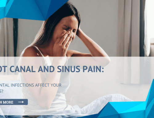 Root Canal and Sinus Pain: Can Dental Infections Affect Your Sinuses?