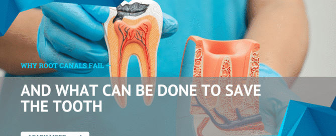 Why Root Canals Fail — And What Can Be Done to Save the Tooth