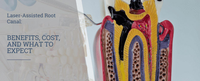 Laser-Assisted Root Canal: Benefits, Cost, and What to Expect