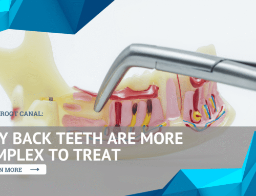 Molar Root Canal: Why Back Teeth Are More Complex to Treat
