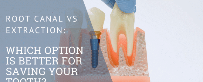 Root Canal vs Extraction: Which Option Is Better for Saving Your Tooth?