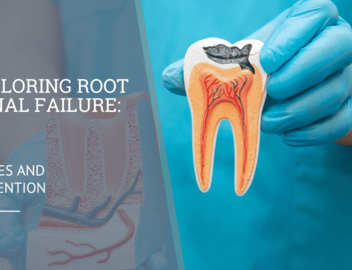 Exploring Root Canal Failure: Causes and Prevention