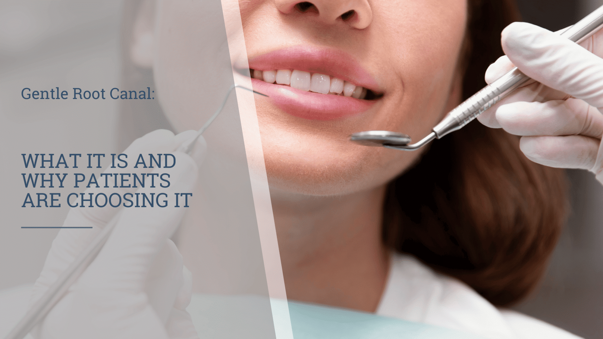 Gentle Root Canal: What It Is and Why Patients Are Choosing It