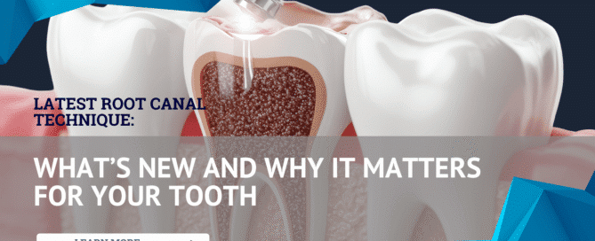 Latest Root Canal Technique: What’s New and Why It Matters for Your Tooth