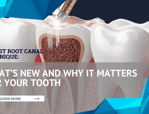Latest Root Canal Technique: What’s New and Why It Matters for Your Tooth