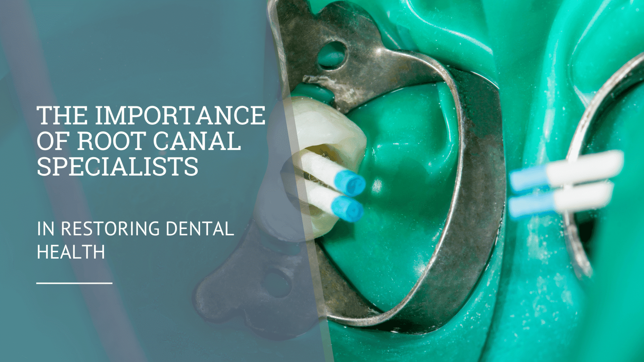 The Importance of Root Canal Specialists in Restoring Dental Health