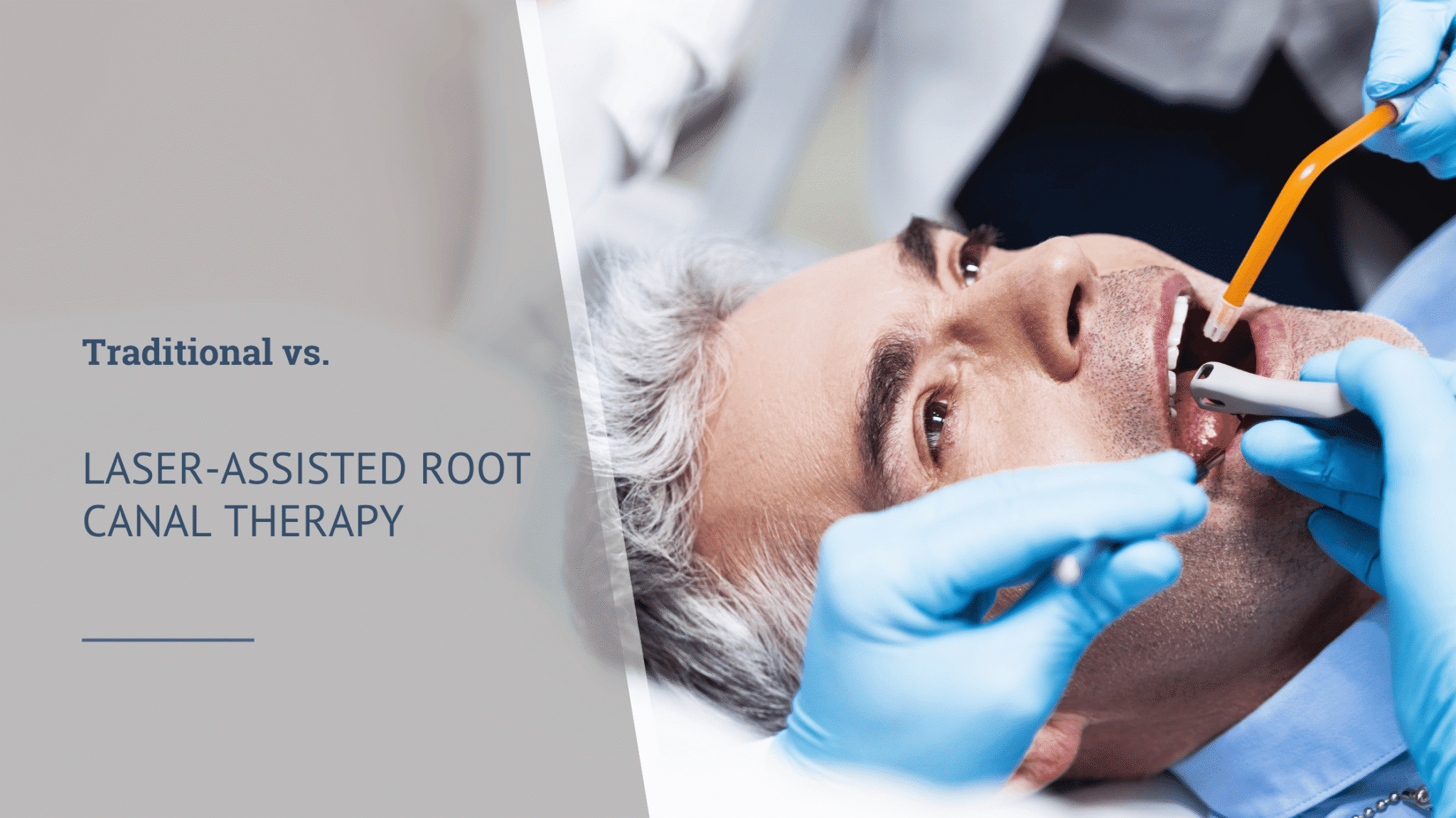 Traditional vs. Laser-Assisted Root Canal Therapy