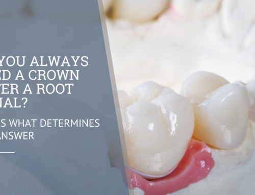 Do You Always Need a Crown After a Root Canal? Here’s What Determines the Answer