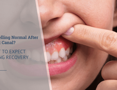 Is Swelling Normal After a Root Canal? What to Expect During Recovery