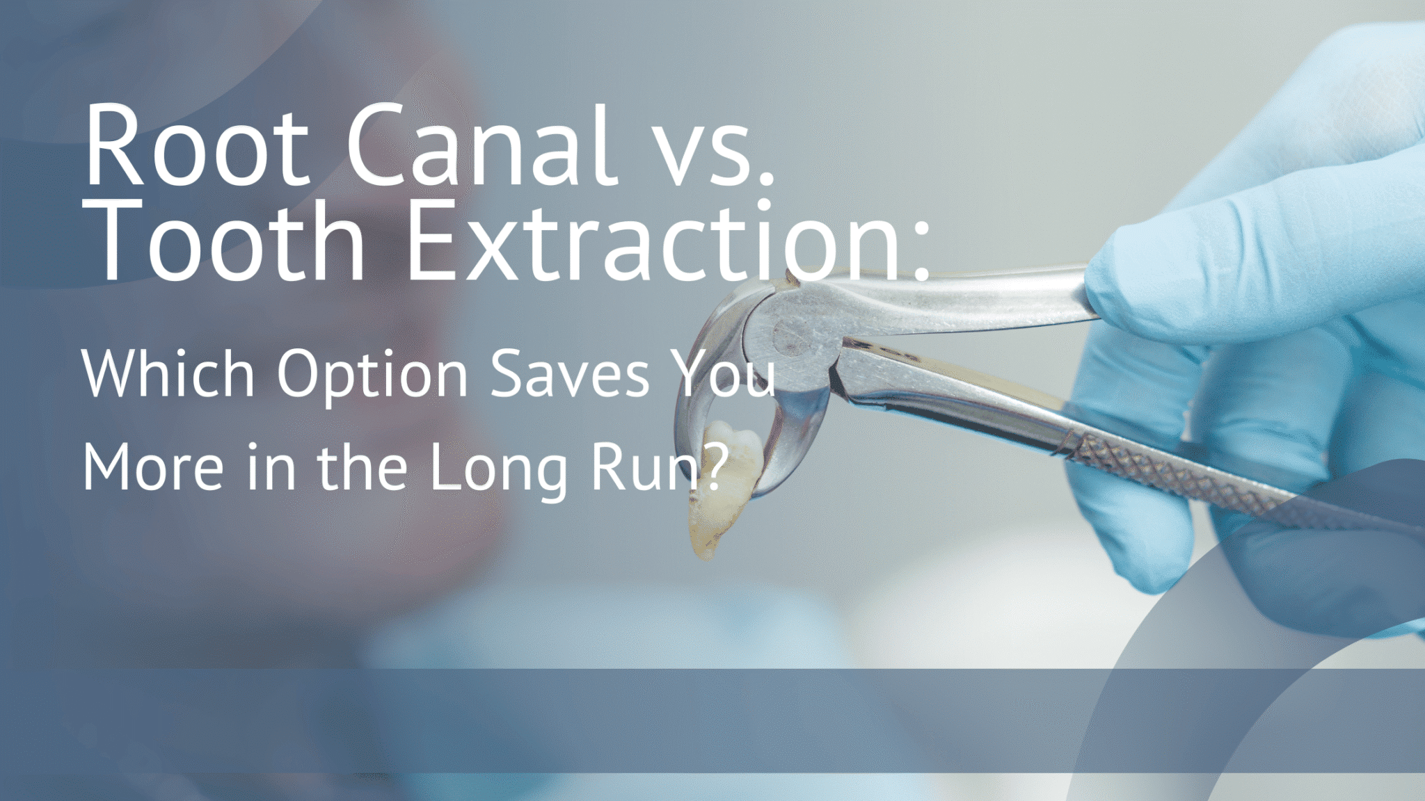 Root Canal vs. Tooth Extraction: