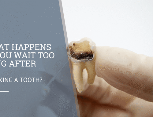 What Happens If You Wait Too Long After Breaking a Tooth?