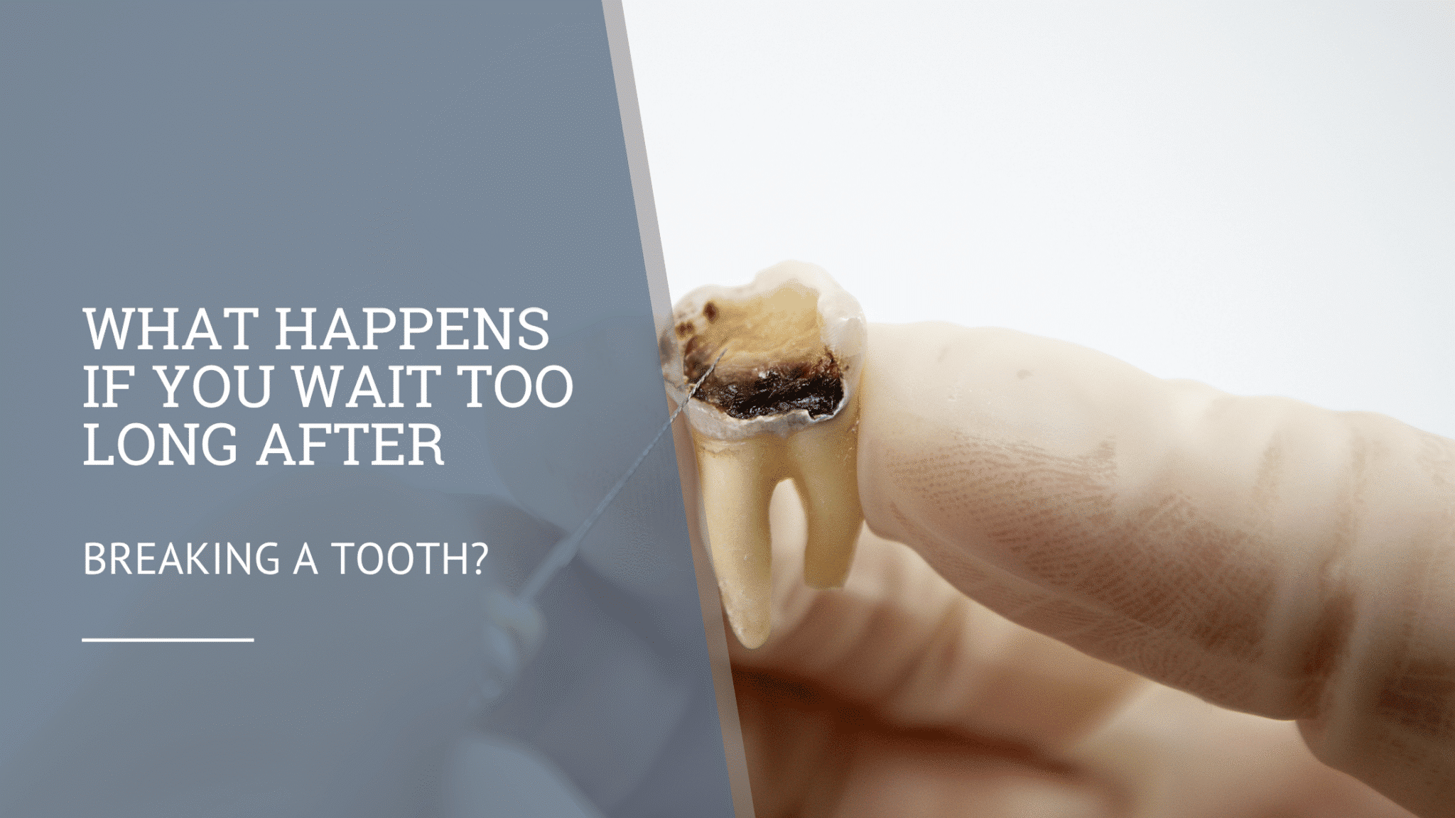 Breaking a Tooth?